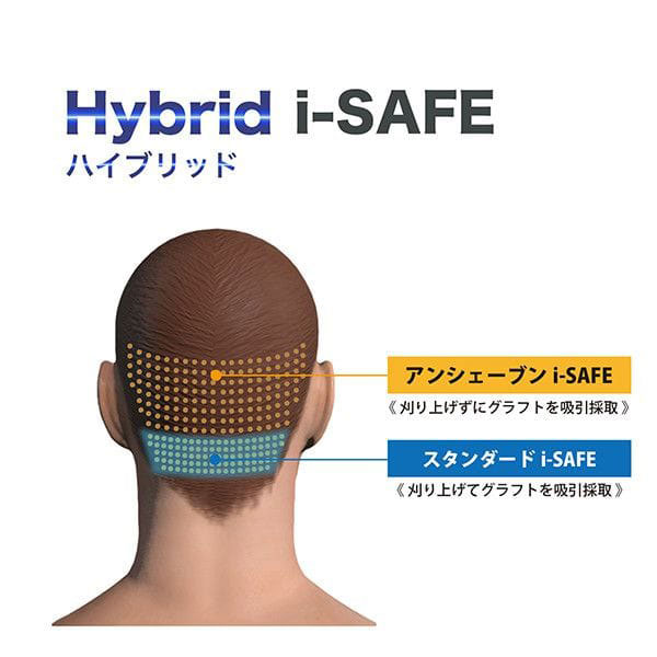 自毛植毛術 ハイブリッドi-SAFE