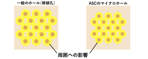 世界最小限のマイクロパンチによる移植孔画像2